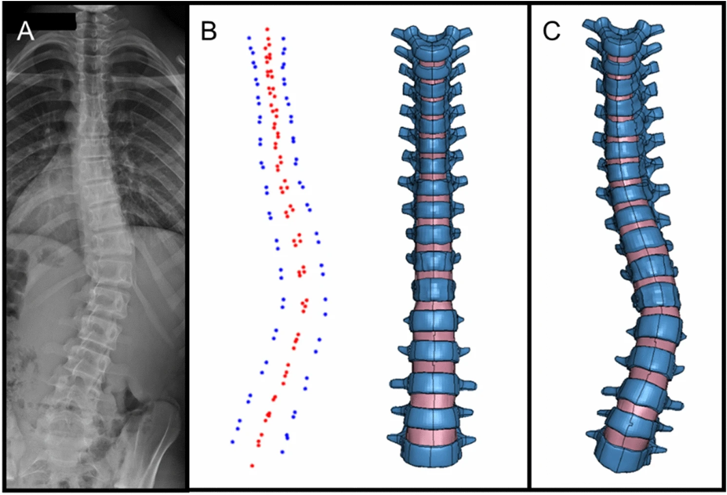Patient-specific FE model generation from X-ray landmark points